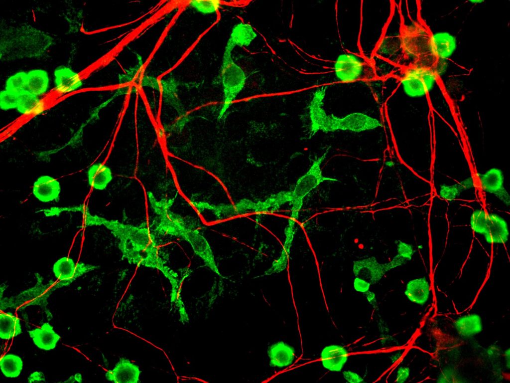 Microglia and Neurons