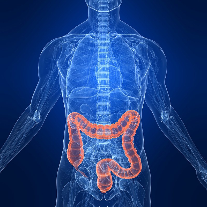 Colorectal Cancer