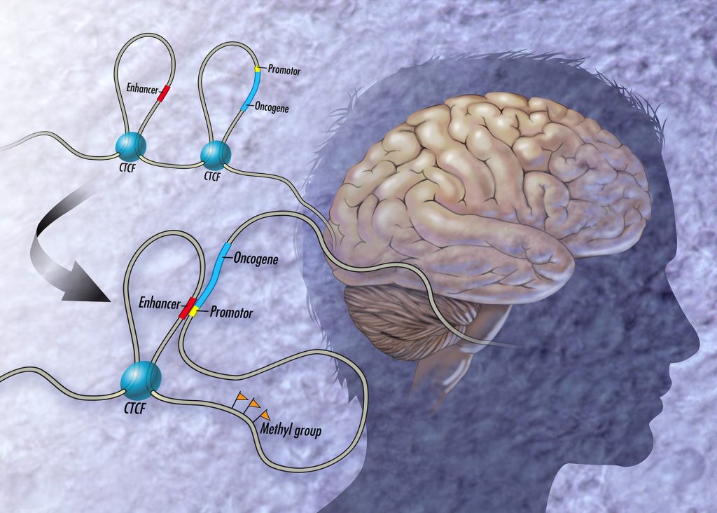 Signs of Brain MTHFR