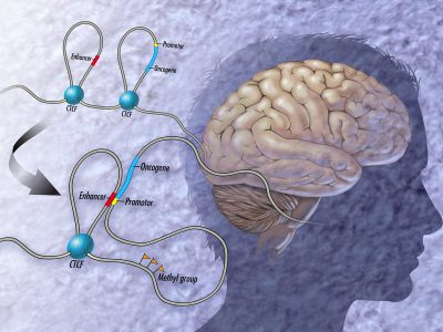 Signs of Brain MTHFR