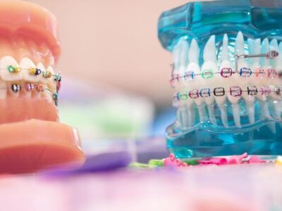 Orthodontic Treatment By Grinz Orthodontics